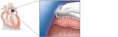Layers of the heart wall and pericardium