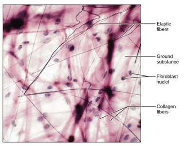Dense connective tissue types