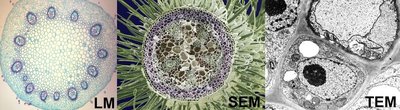 Light, scanning, and transmission electron microscopy images