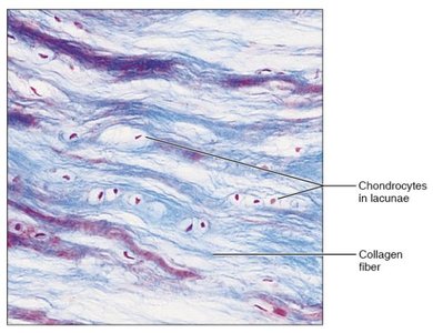 Bone tissue