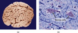 Brain and neuron cells