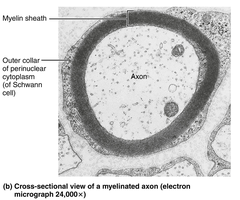 Cross-sectional view of a myelinated axon