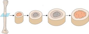 Appositional growth of bone