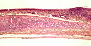 Histological section showing perichondrium surrounding cartilage