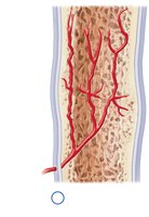 Healed fracture and bone remodeling