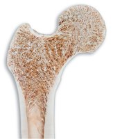 Section of bone showing spongy and compact bone