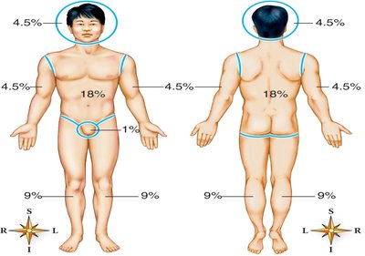 Rule of nines for estimating burn area