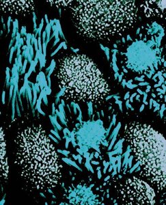 Microvilli and cilia under microscope