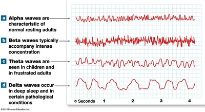 EEG waveforms: alpha, beta, theta, delta