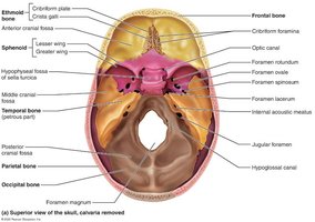 Superior view of the skull highlighting sphenoid bone and foramina