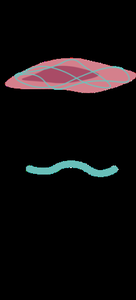 Collagen fiber arrangement in reticular layer