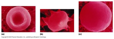 Red blood cells in isotonic, hypertonic, and hypotonic solutions