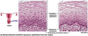 Stratified squamous non-keratinized epithelium