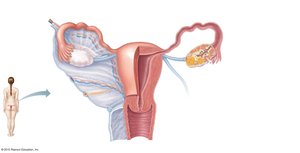 Anatomy of the female reproductive system, sagittal and frontal views