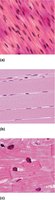Histological comparison of muscle types: smooth, skeletal, cardiac