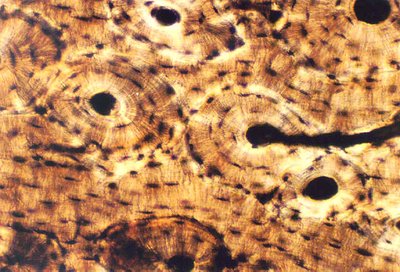 Microscopic view of compact bone showing osteons, lamellae, and lacunae