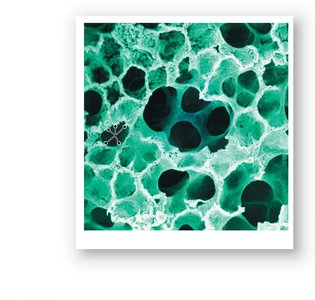 SEM of alveoli in lung tissue