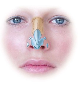 Nasal cartilages and external nose