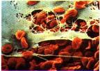 Blood clot formation