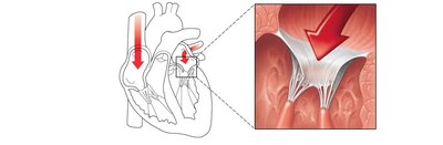 AV valves open during ventricular filling