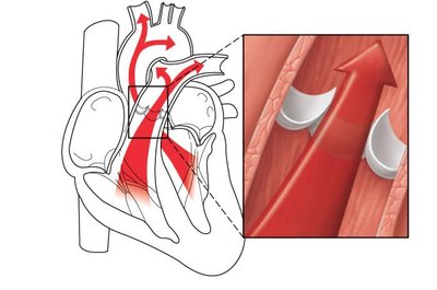 Semilunar valves open during ventricular ejection