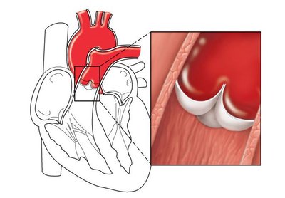 Semilunar valves closed during ventricular relaxation