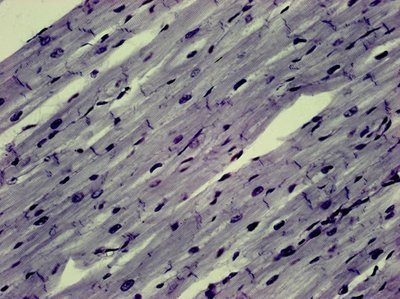 Cardiac muscle tissue under microscope