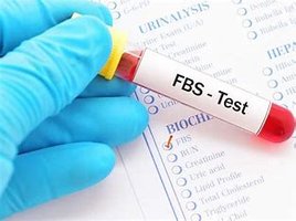 FBS test tube and lab form