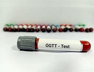 OGTT test tube