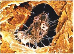 Osteocyte in lacuna