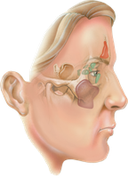Lateral view of paranasal sinuses