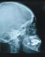 Cranial and facial divisions of the skull with major sutures