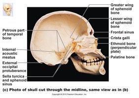 Inferior view of the skull with labeled features