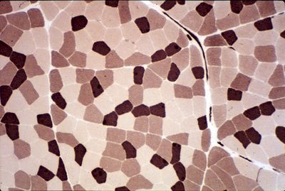 Muscle cross-section showing distribution of fiber types