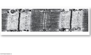 Sarcomere structure, micrograph longitudinal section