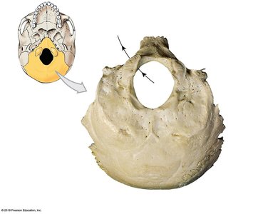 Inferior view of the occipital bone