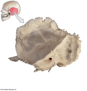 Medial view of the right temporal bone