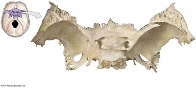 Superior surface of the sphenoid bone