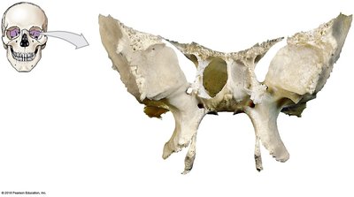 Anterior surface of the sphenoid bone