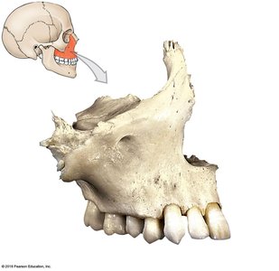 Lateral view of the right maxilla