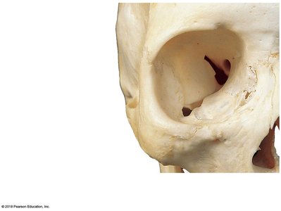 Bones of the orbital complex, alternate view