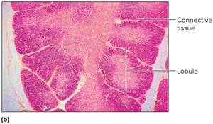 Micrograph of thymus showing lobules and connective tissue