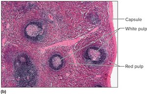 Micrograph of spleen showing white and red pulp