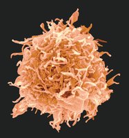 Scanning electron micrograph of a B cell