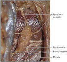 Lymph node with lymphatic vessels