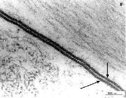 Fluid mosaic model of the membrane