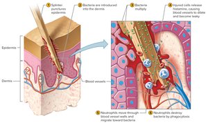 WBC response to bacterial invasion