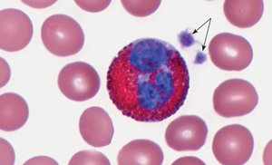 Eosinophil