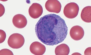 Monocyte