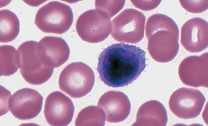 Lymphocyte